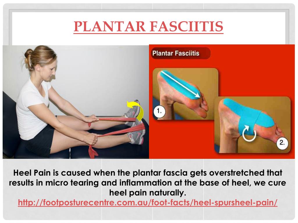 Good Shoes For Plantar Fasciitis