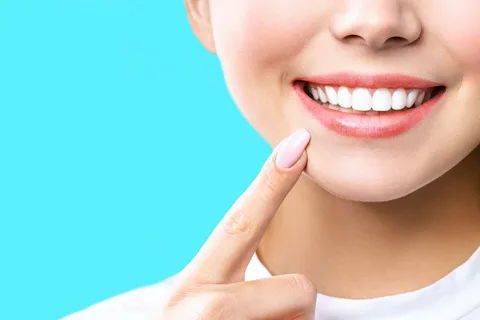 teeth whitening Marrickville